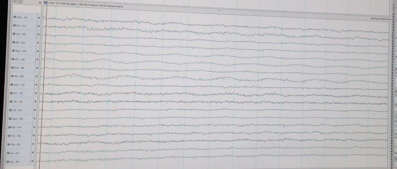 eeg-image 1